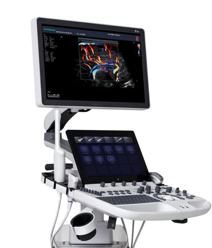 SONOGRAFO SONOSCAPE CARDIOLOGIA  P40 ELITE PLUS SONOSCAPE